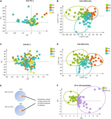 Metabolomic Analysis Uncovers Lipid and Amino Acid Metabolism Disturbance During the Development of Ascites in Alcoholic Liver Disease